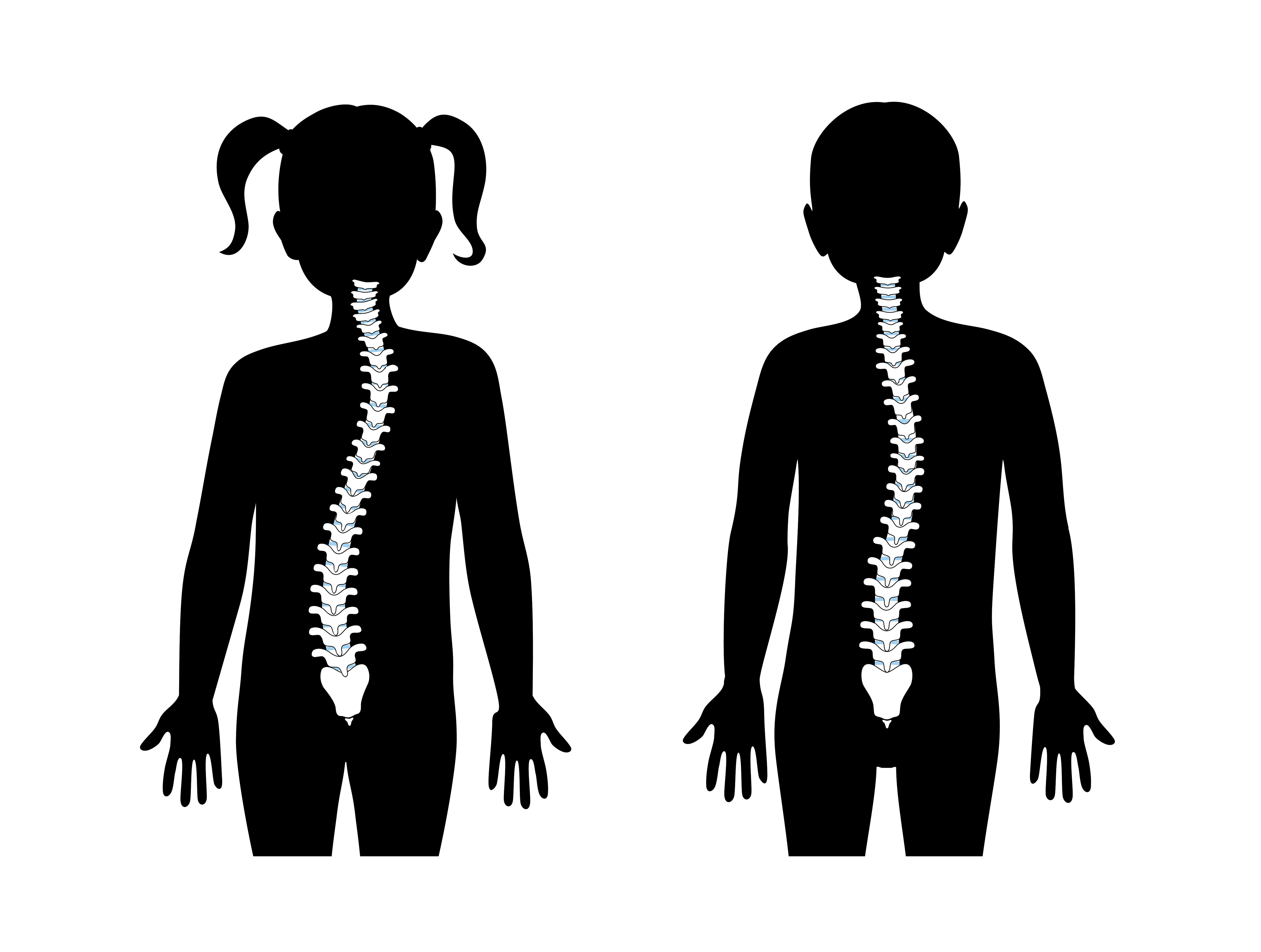 【家長必看】兒童常見脊椎脊骨問題和痛症